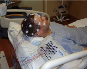 patient undergoing EEG